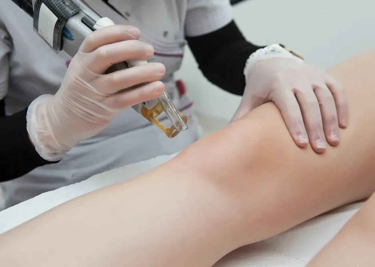 Hair Laser Removal